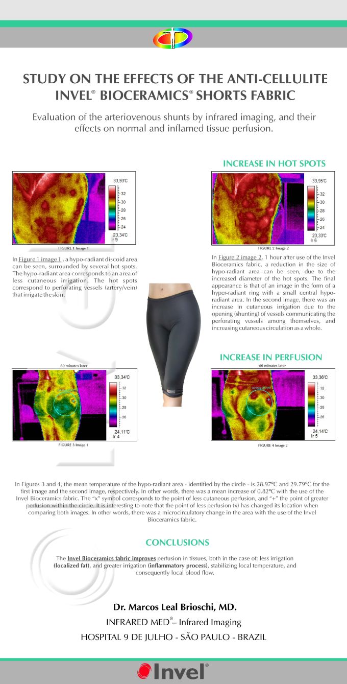Infrared thermography of skin perfusion under Invel® Bioceramics fabric